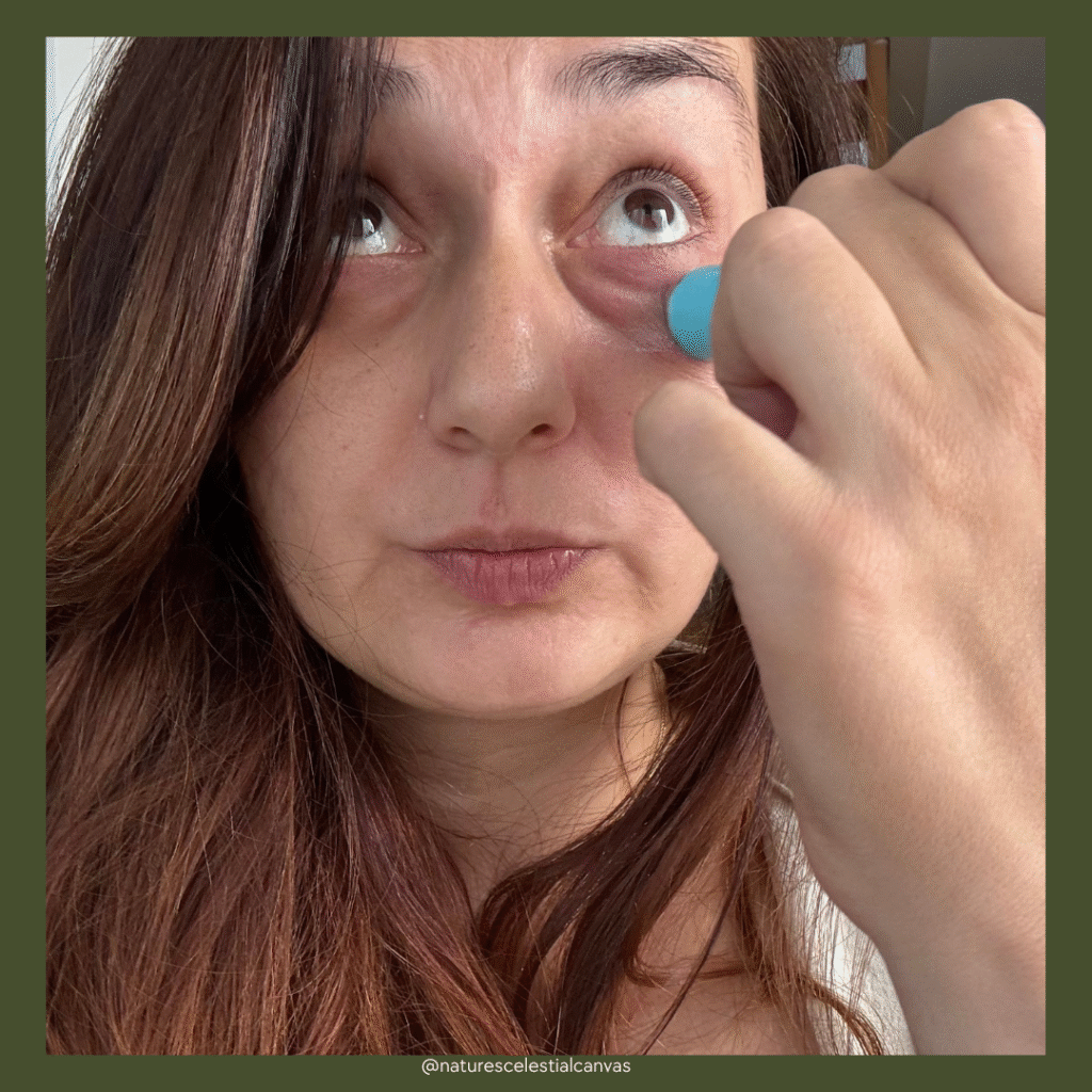 before and applying product on How Do I Get Rid of My Dark Under Eye Circles?